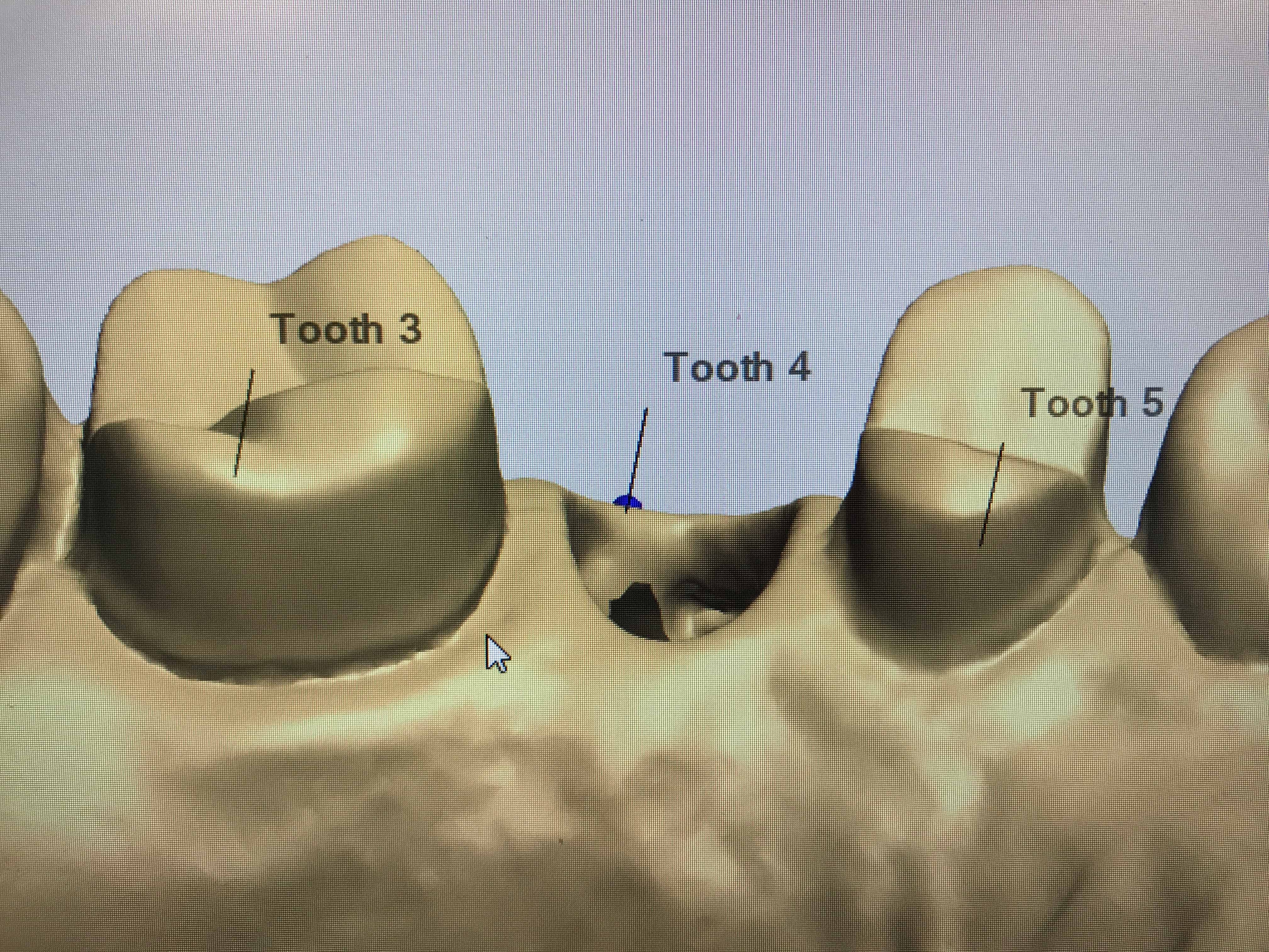 Implant Connections August 79, 2020 Stevenson Dental Solutions