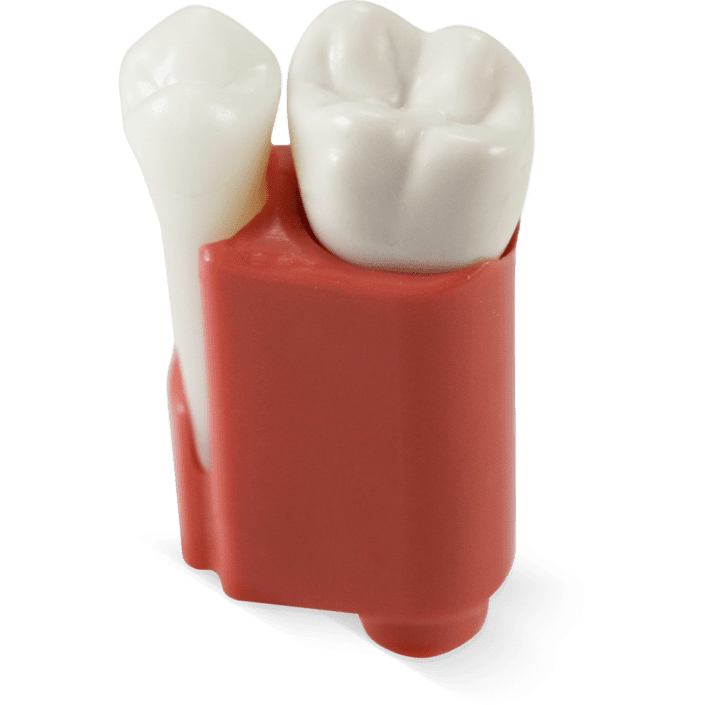 endo-tooth-acadental-8-real-t-endo-cdca-adex-exam-stevenson-dental